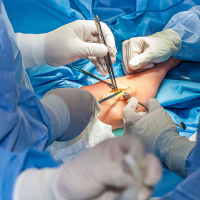 Elbow Arthroscopy In Guntur