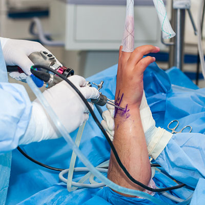Wrist Arthroscopy Surgery In Guntur